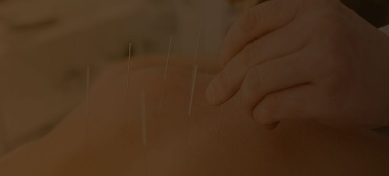 marketing para clínicas de acupuntura
